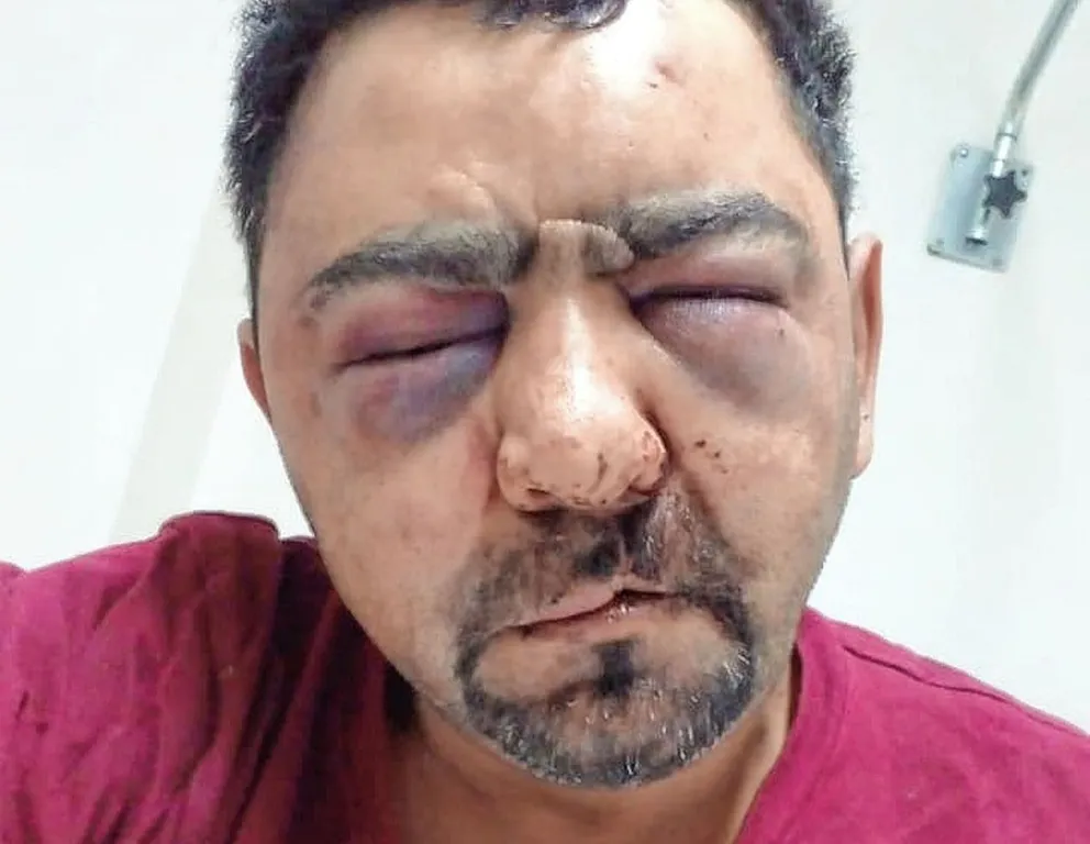 Avanza la investigación contra los policías sumariados por la brutal golpiza a Bonina