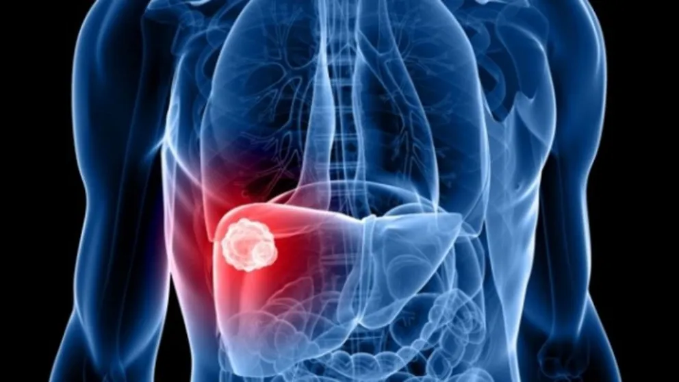 La importancia de prevenir las hepatitis virales